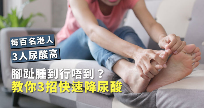 腳趾腫到行唔到？每100名港人有3人尿酸高 3招快速降尿酸