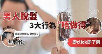 3大致命行為易脫髮！守住男士尊嚴要點拆？ - Vita Green