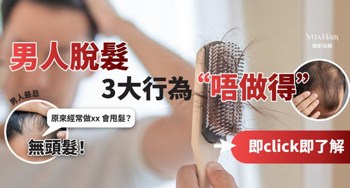 3大致命行為易脫髮！守住男士尊嚴要點拆？ - Vita Green