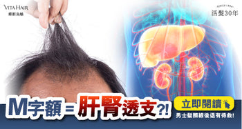M 字額是身體的無聲抗議？拆解男士脫髮與「肝腎透支」的隱秘關聯