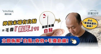 掉髮末端有白點 = 毛囊「假死」？！是「頭頂沙漠化」前兆迷思 - Vita Green