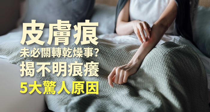 皮膚痕癢未必關轉季天氣乾燥事？皮膚不明痕癢潛藏5大原因｜維特健靈 - Vita Green