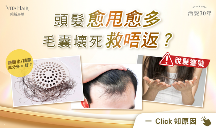 頭髮keep住甩？仲有冇得救？