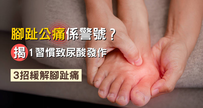 腳趾公痛係尿酸高？1壞習慣係尿酸發作大忌！3招對付腳趾腫痛