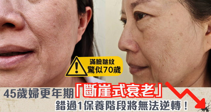 更年期係女人天敵？錯過XX歲黃金保養期恐「斷崖式衰老」！