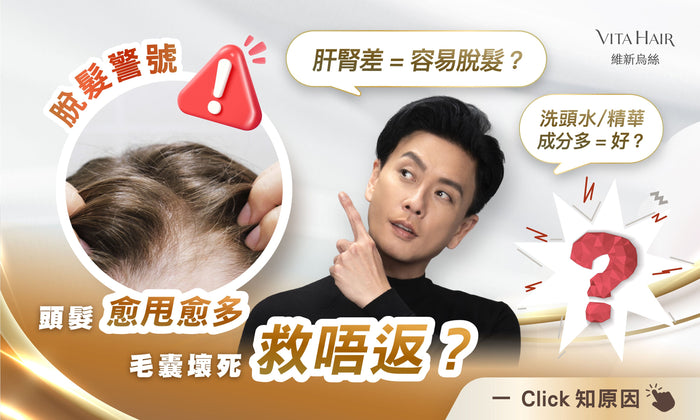 【小心頭髮愈甩愈多，毛囊壞死救唔返？】